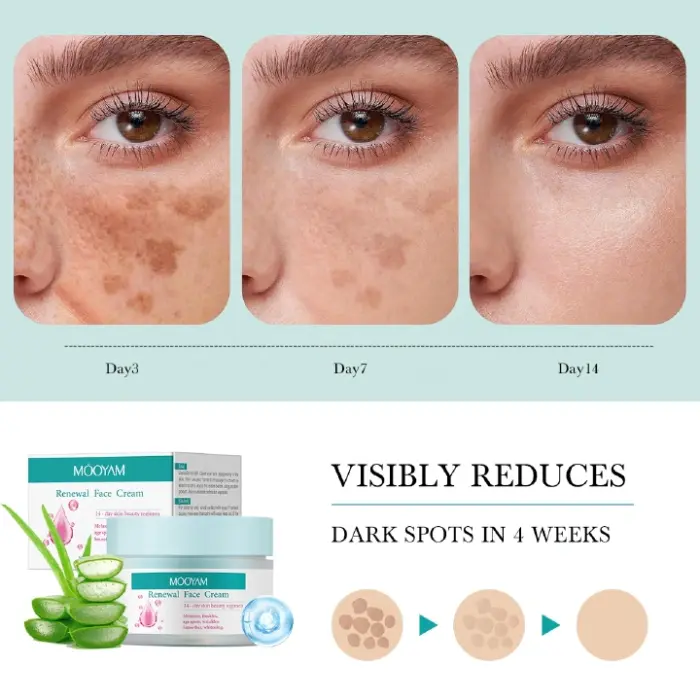 MOOYAM Renewal Face Cream for Melasma and Freckles Treatment, Age Spots Brightening, Anti-wrinkle, Smoother and Whitening Face Cream Renewal Facial Cream 2