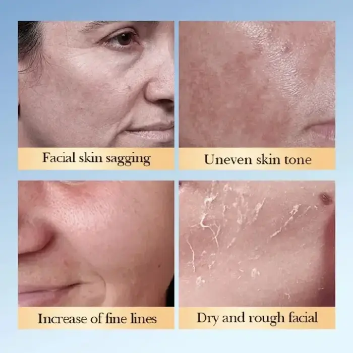 SADOER 7% Glycolic Acid + Ceramide Toner 230ml For Skin Renewal, Exfoliation, Anti-Dark Spots, Smooth Texture & Radiant Youthful Glow Brightens, And Restores Skin For A Clear, Smooth And Radiant Glow 3