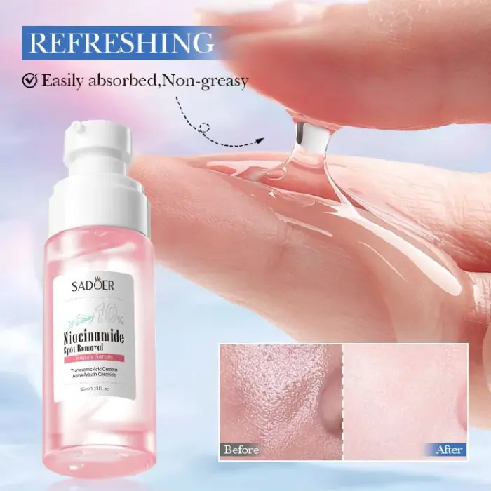 Sadoer Niacinamide Repair Serum Spot Removal with Tranexamic Acid Centella Alpha Arbutin, Ceramide Deep Whitenening, Brightening Nourish, Reduce Pigmentation, Soothing Hydrating Face Inhibits Melanin 3